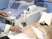 image of woman having an ultrasound scan